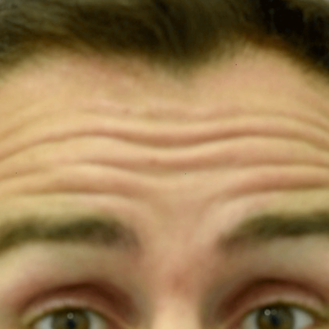 Antes