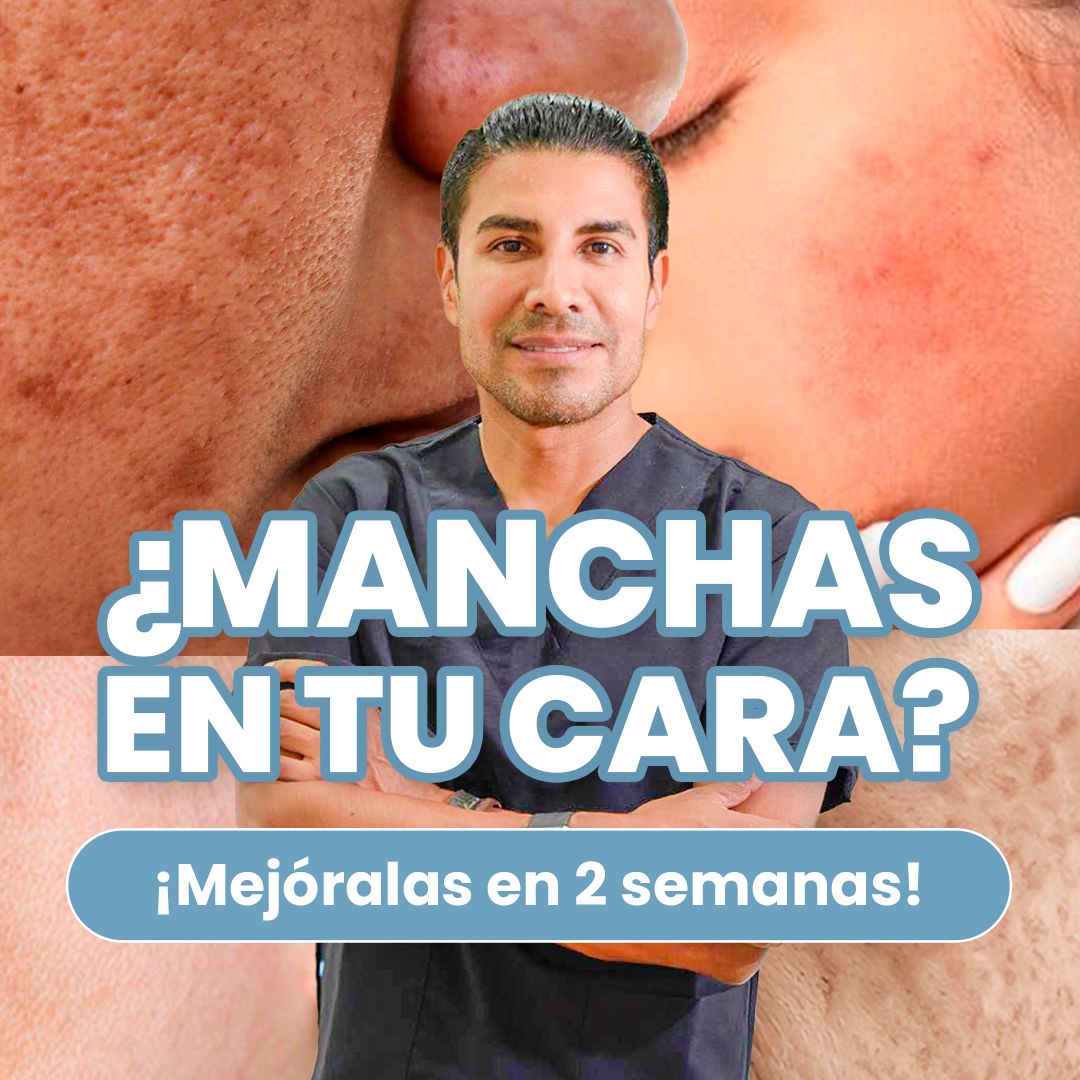 Elimina manchas de la cara en 2 semanas