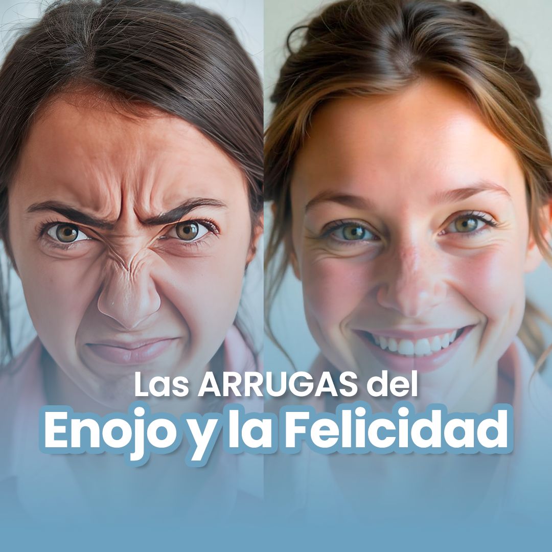 Me aparecen arrugas cuando me enojo y sonrío